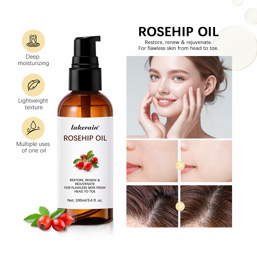 Face Oil Rosehip - 100ml multifuncional hidratar óleo essencial de