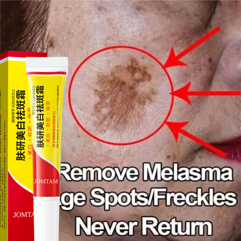 Skincare Niacinamide - Creme Clareador de Manchas Faciais com